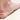 How to Reduce Risks and Symptoms of Foot Blisters